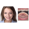 Лечение ,  протезирование и имплантация зубов в Полтаве на выгодных условиях