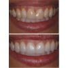 Лечение ,  протезирование и имплантация зубов в Полтаве на выгодных условиях
